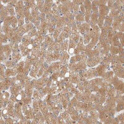 Immunohistochemistry-Paraffin: N-Acetylmannosamine Kinase/GNE Antibody [NBP1-81621] - Staining of human liver shows moderate cytoplasmic positivity in hepatocytes.