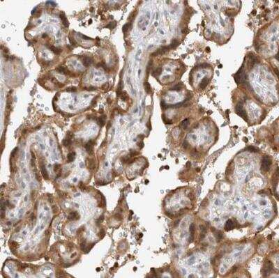 Immunohistochemistry-Paraffin N-Acetylmannosamine Kinase/GNE Antibody