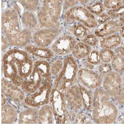 Immunohistochemistry-Paraffin N-Acetylmannosamine Kinase/GNE Antibody