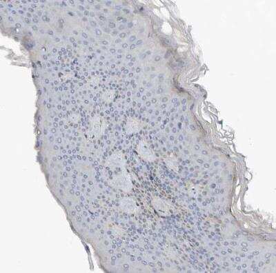 Immunohistochemistry-Paraffin N-Acetylmannosamine Kinase/GNE Antibody