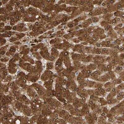 Immunohistochemistry-Paraffin: N-Acetylmannosamine Kinase/GNE Antibody [NBP1-81622] - Staining of human liver shows strong cytoplasmic and nuclear positivity in hepatocytes.