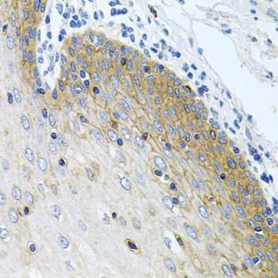 Immunohistochemistry-Paraffin: N-Acetylmannosamine Kinase/GNE Antibody [NBP2-94770] - Paraffin-embedded human esophagus using N-Acetylmannosamine Kinase/GNE .