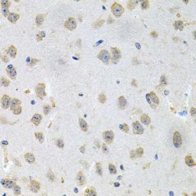 Immunohistochemistry-Paraffin: N-Acetylmannosamine Kinase/GNE Antibody [NBP2-94770] - Paraffin-embedded mouse brain using N-Acetylmannosamine Kinase/GNE .