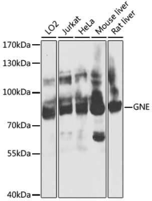 Western Blot: N-Acetylmannosamine Kinase/GNE Antibody [NBP2-94770] - Analysis of extracts of various cell lines, using N-Acetylmannosamine Kinase/GNE at 1:1000 dilution.Secondary antibody: HRP Goat Anti-Rabbit IgG (H+L) at 1:10000 dilution.Lysates/proteins: 25ug per lane.Blocking buffer: 3% nonfat dry milk in TBST.Detection: ECL Basic Kit .Exposure time: 10s.