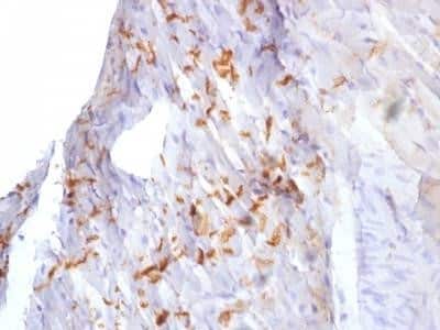 Immunohistochemistry-Paraffin: N-Cadherin Antibody (8C11) - Azide and BSA Free [NBP2-54523] - Mouse heart stained with N-Cadherein antibody (8C11).