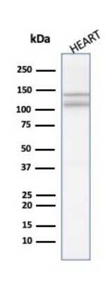 Western Blot: N-Cadherin Antibody (8C11) - Azide and BSA Free [NBP2-54523] - Western blot analysis of Heart tissue lysate using N-Cadherin antibody (8C11).