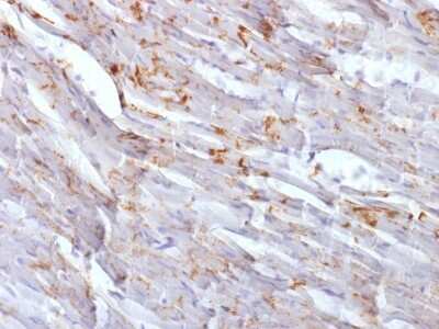 Immunohistochemistry-Paraffin: N-Cadherin Antibody (CDH2/1573) [NBP2-54522] - Formalin-fixed, paraffin-embedded Mouse Heart stained with N-Cadherin Monoclonal Antibody (CDH2/1573).