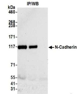 Immunoprecipitation: N-Cadherin Antibody [NBP3-14690] - Whole cell lysate (1.0 mgper IP reaction; 20% of IP loaded) from HeLa cells preparedusing NETN lysis buffer. Antibodies: Rabbit anti-NCadherin recombinant monoclonal antibody used for IP at 12 ul per reaction. NCadherin was also immunoprecipitated by rabbit anti-NCadherin antibody. For blottingimmunoprecipitated N-Cadherin, was used at1:1000. Chemiluminescence with an exposure time of 10seconds.