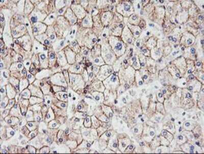 Immunohistochemistry: N-Cadherin Antibody (OTI2G7) - Azide and BSA Free [NBP2-72891] - Staining of paraffin-embedded Human liver tissue using anti-N Cadherin mouse monoclonal antibody.