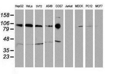 Western Blot: N-Cadherin Antibody (OTI2G7) - Azide and BSA Free [NBP2-72891] - Analysis of extracts (35ug) from 9 different cell lines by using anti-N Cadherin monoclonal antibody.