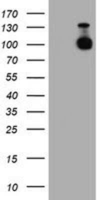 Western Blot: N-Cadherin Antibody (OTI2G7) - Azide and BSA Free [NBP2-72891] - HEK293T cells were transfected with the pCMV6-ENTRY control (Left lane) or pCMV6-ENTRY N Cadherin (Right lane) cDNA for 48 hrs and lysed. Equivalent amounts of cell lysates (5 ug per lane) were separated by SDS-PAGE and immunoblotted with anti-N Cadherin.