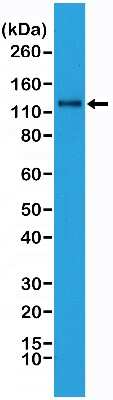 Western Blot: N-Cadherin Antibody (RM259) [NBP2-61566] - Western Blot analysis of HeLa whole cell lysates, using Anti-N-cadherin Rabbit monoclonal antibody (NBP2-61566), showed N-cadherin expression in HeLa cells.