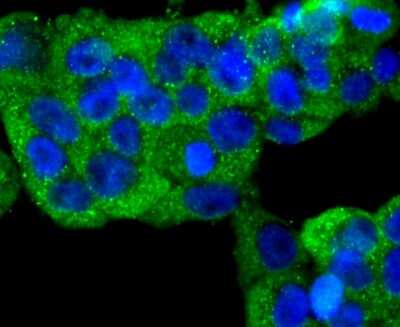 Immunocytochemistry/Immunofluorescence: N-Cadherin Antibody (SY02-46) [NBP2-67431] - Staining N Cadherin in NCCIT cells (green). The nuclear counter stain is DAPI (blue). Cells were fixed in paraformaldehyde, permeabilised with 0.25% Triton X100/PBS.