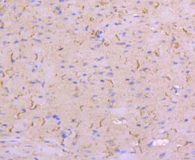 Immunohistochemistry-Paraffin: N-Cadherin Antibody (SY02-46) [NBP2-67431] - Analysis of paraffin-embedded mouse heart tissue using anti-N Cadherin antibody. Counter stained with hematoxylin.
