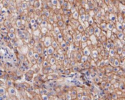 Immunohistochemistry-Paraffin: N-Cadherin Antibody (SY02-46) [NBP2-67431] - Immunohistochemical analysis of paraffin-embedded human liver tissue using anti-N Cadherin antibody. Counter stained with hematoxylin.