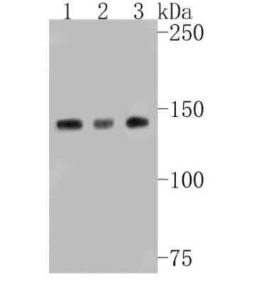 Western Blot: N-Cadherin Antibody (SY02-46) [NBP2-67431] - Analysis of N Cadherin on different lysates. Proteins were transferred to a PVDF membrane and blocked with 5% BSA in PBS for 1 hour at room temperature. The primary antibody (1/500) was used in 5% BSA at room temperature for 2 hours. Goat Anti-Rabbit IgG - HRP Secondary Antibody at 1:5,000 dilution was used for 1 hour at room temperature. Positive control: Lane 1: SH-SY5Y cell lysate Lane 2: Hela cell lysate Lane 3: NIH/3T3 cell lysate
