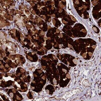 Immunohistochemistry-Paraffin: N-Deacetylase/N-Sulfotransferase 2/NDST2 Antibody [NBP2-13645] - Staining of human stomach (lower) shows strong cytoplasmic positivity in glandular cells.