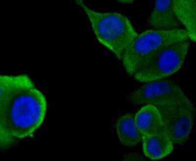 Immunocytochemistry/Immunofluorescence: N-WASP Antibody (JU07-31) [NBP2-75599] - Staining WASL in SK-Br-3 cells (green). The nuclear counter stain is DAPI (blue). Cells were fixed in paraformaldehyde, permeabilised with 0.25% Triton X100/PBS.
