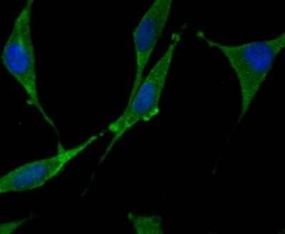 Immunocytochemistry/Immunofluorescence: N-WASP Antibody (JU07-31) [NBP2-75599] - Staining WASL in SH-SY5Y cells (green). The nuclear counter stain is DAPI (blue). Cells were fixed in paraformaldehyde, permeabilised with 0.25% Triton X100/PBS.