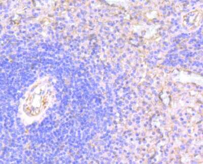Immunohistochemistry-Paraffin: N-WASP Antibody (JU07-31) [NBP2-75599] - Analysis of paraffin-embedded human spleen tissue using anti-WASL antibody. Counter stained with hematoxylin.