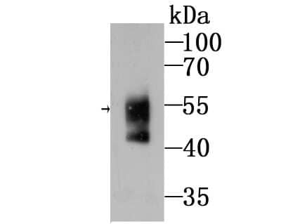 Western Blot: N-WASP Antibody (JU07-31) [NBP2-75599] - Analysis of WASL on mouse Human serum lysates using anti-Ubiquitin antibody at 1/500 dilution.