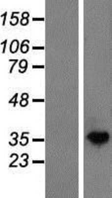 Western Blot: N acetylglucosamine kinase Overexpression Lysate (Adult Normal) [NBP2-06964] Left-Empty vector transfected control cell lysate (HEK293 cell lysate); Right -Over-expression Lysate for N acetylglucosamine kinase.