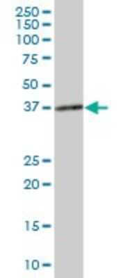 Western Blot: N myc interactor Antibody [H00009111-B01P] - Analysis of NMI expression in human spleen.
