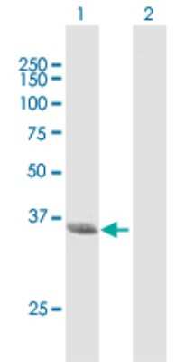Western Blot: N myc interactor Antibody [H00009111-B01P] - Analysis of NMI expression in transfected 293T cell line by NMI polyclonal antibody.  Lane 1: NMI transfected lysate(33.77 KDa). Lane 2: Non-transfected lysate.