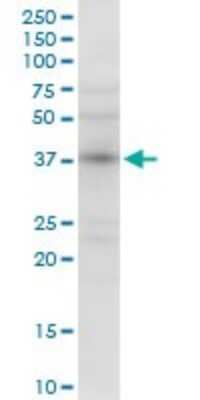 Western Blot: N myc interactor Antibody [H00009111-D01P] - Analysis of NMI expression in A-431.