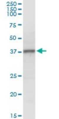 Western Blot: N myc interactor Antibody [H00009111-D01P] - Analysis of NMI expression in human spleen.