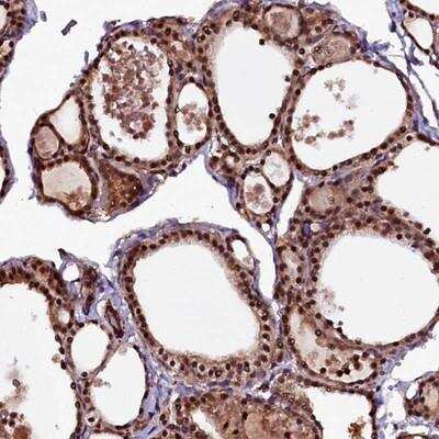 Immunohistochemistry-Paraffin: N4BP1 Antibody [NBP1-86233] - Staining of human thyroid gland shows strong nuclear and cytoplasmic positivity in glandular cells.