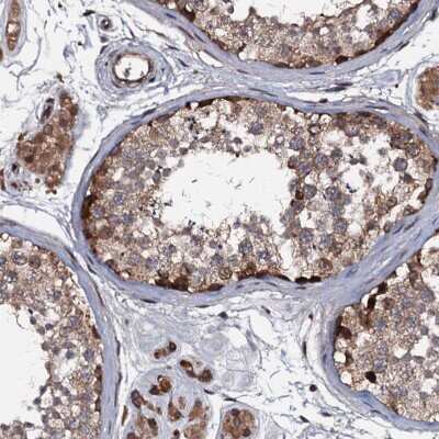 Immunohistochemistry-Paraffin: N4BP1 Antibody [NBP1-86238] - Staining of human testis shows strong cytoplasmic and nuclear positivity in cells in seminiferous ducts.