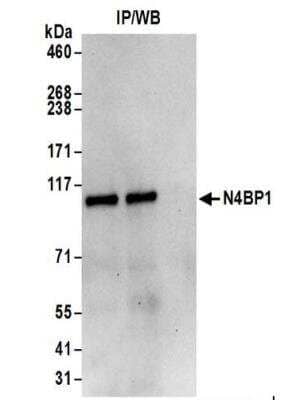 <b>Biological Strategies Validation. </b>Immunoprecipitation: N4BP1 Antibody [NBP2-37688] - Whole cell lysate (0.5 or 1.0 mg per IP reaction; 20% of IP loaded) from 293T cells prepared using NETN lysis buffer.  Affinity purified rabbit anti-N4BP1 antibody  used for IP at 6 ug per reaction.  N4BP1 was also immunoprecipitated by rabbit anti-N4BP1 antibody BL17672.  For blotting immunoprecipitated N4BP1,  was used at 1 ug/ml.  Detection: Chemiluminescence with an exposure time of 30 seconds.
