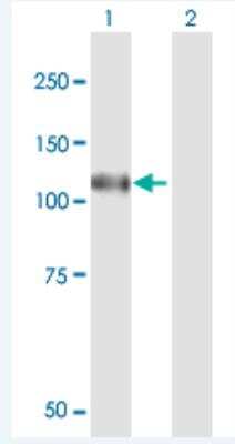 Western Blot: N4BP1 Antibody [H00009683-B01P-50ug] - Analysis of N4BP1 expression in transfected 293T cell line (H00009683-T01) by N4BP1 MaxPab polyclonal antibody.  Lane 1: N4BP1 transfected lysate(98.56 KDa). Lane 2: Non-transfected lysate.