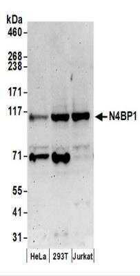 Western Blot N4BP1 Antibody - BSA Free
