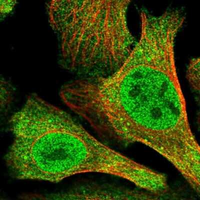 Immunocytochemistry/Immunofluorescence: N4BP2 Antibody [NBP2-59017] - Staining of human cell line U-2 OS shows localization to nucleoplasm, plasma membrane & cytosol. Antibody staining is shown in green. 