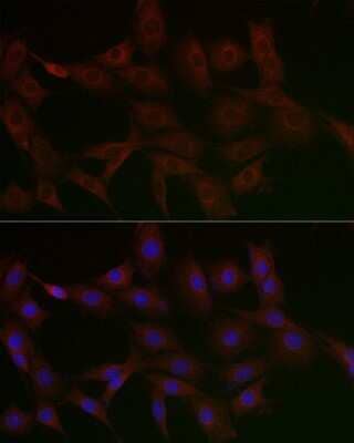 Immunocytochemistry/Immunofluorescence: N4BP2 Antibody [NBP3-16022] - Immunofluorescence analysis of PC-12 cells using N4BP2 Rabbit pAb (NBP3-16022) at dilution of 1:50 (40x lens). Blue: DAPI for nuclear staining.