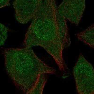 Immunocytochemistry/ Immunofluorescence N4BP2 Antibody - BSA Free
