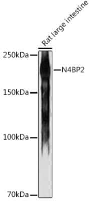 Western Blot: N4BP2 Antibody [NBP3-16022] - Western blot analysis of extracts of Rat large intestine, using N4BP2 antibody (NBP3-16022) at 1:1000 dilution. Secondary antibody: HRP Goat Anti-Rabbit IgG (H+L) at 1:10000 dilution. Lysates/proteins: 25ug per lane. Blocking buffer: 3% nonfat dry milk in TBST. Detection: ECL Enhanced Kit. Exposure time: 180s.