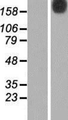 Western Blot: N4BP2 Overexpression Lysate (Adult Normal) [NBP2-06812] Left-Empty vector transfected control cell lysate (HEK293 cell lysate); Right -Over-expression Lysate for N4BP2.