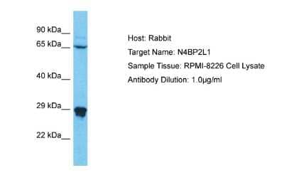 Western Blot: N4BP2L1 Antibody [NBP2-83250] - Host: Rabbit. Target Name: N4BP2L1. Sample Type: RPMI-8226 Whole Cell lysates. Antibody Dilution: 1.0ug/mlN4BP2L1 is strongly supported by BioGPS gene expression data to be expressed in RPMI-8226