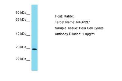 Western Blot: N4BP2L1 Antibody [NBP2-83251] - Host: Rabbit. Target Name: N4BP2L1. Sample Type: Hela Whole Cell lysates. Antibody Dilution: 1.0ug/ml
