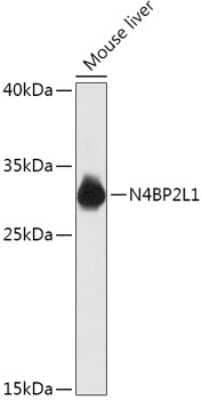 Western Blot: N4BP2L1 Antibody [NBP2-94417] - Analysis of extracts of Mouse liver, using N4BP2L1 at 1:1000 dilution.Secondary antibody: HRP Goat Anti-Rabbit IgG (H+L) at 1:10000 dilution.Lysates/proteins: 25ug per lane.Blocking buffer: 3% nonfat dry milk in TBST.Detection: ECL Basic Kit .Exposure time: 60s.