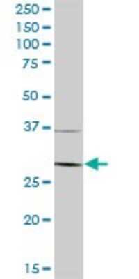 Western Blot: NAA10 Antibody [H00008260-B01P] - Analysis of ARD1A expression in human pancreas.
