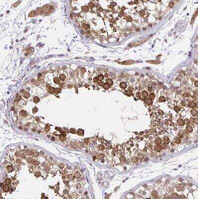 Immunohistochemistry-Paraffin: NAALADase-2/NAALAD2 Antibody [NBP2-31840] - Staining of human testis shows strong cytoplasmic positivity in cells in seminiferous ducts.