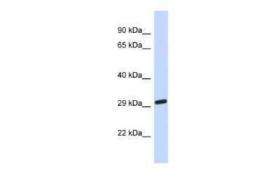 Western Blot: NAALADase-2/NAALAD2 Antibody [NBP2-87875] - Host: Rabbit. Target Name: NAALAD2. Sample Type: Fetal Brain lysates. Antibody Dilution: 1.0ug/ml
