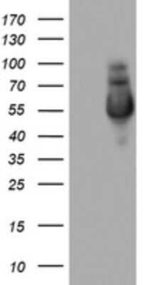 Western Blot: NAB1 Antibody (1D2) [NBP2-46079] - Analysis of HEK293T cells were transfected with the pCMV6-ENTRY control (Left lane) or pCMV6-ENTRY NAB1.