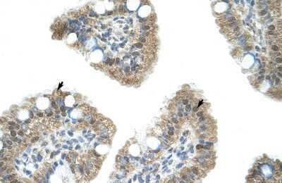 Immunohistochemistry: NAB1 Antibody [NBP2-87876] - Human Intestine