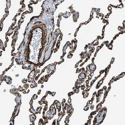 Immunohistochemistry-Paraffin: NAB1 Antibody [NBP1-86163] - Staining of human lung shows strong membranous positivity in alveolar cells and distinct staining in vessel wall.