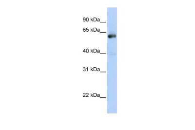 Western Blot: NAB1 Antibody [NBP2-87877] - WB Suggested Anti-NAB1 Antibody Titration: 0.2-1 ug/ml. ELISA Titer: 1:312500. Positive Control: Transfected 293T